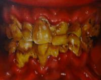 Teeth - Oils Paintings - By Sean King, Realism Painting Artist